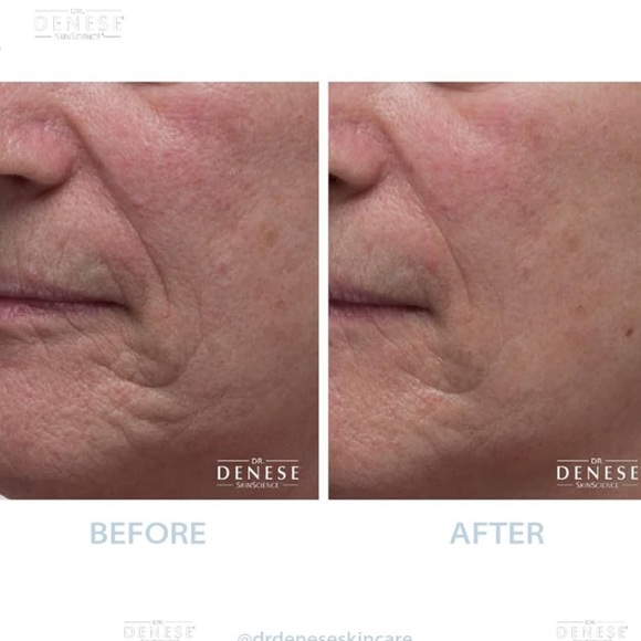 Dr. Denese Collagen Firming Peel Off Mask - Picture 2 of 2